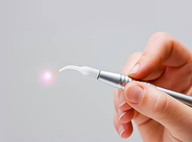 soft tissue laser