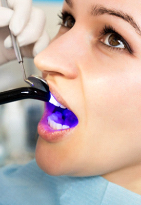 Dentist applying UV light to woman’s dental filling