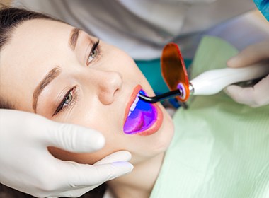 woman getting dental sealants