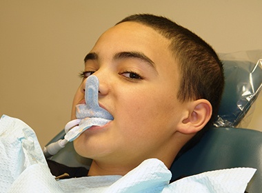 boy getting fluoride