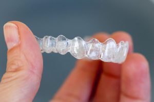 Your dentist near Whitehall discusses Invisalign.