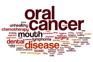 oral cancer