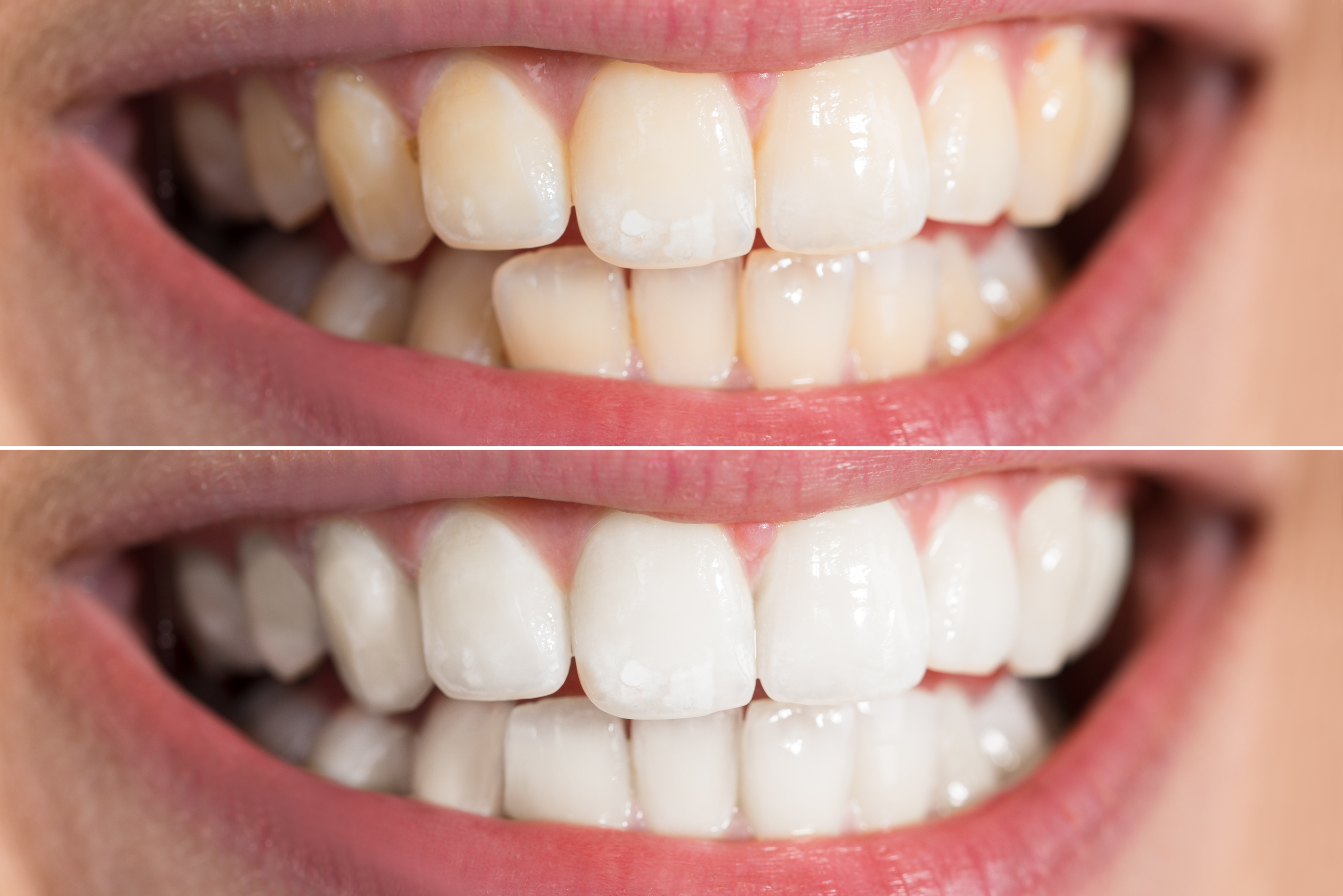Your Lehigh Valley Dentist For A Bright White Smile