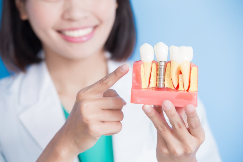 Model of dental implants in Lehigh Valley