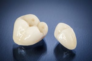 Tooth-colored dental crown from dentist in the Lehigh Valley