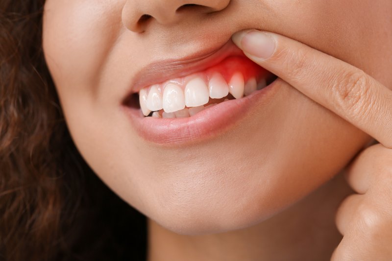A woman with inflamed gums