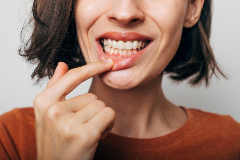 Woman shows inflamed gum